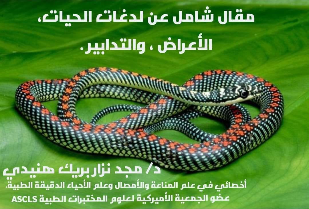 لدغ الحيات، ماذا نفعل؟