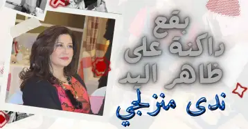 بقع داكنة على ظاهر اليد!! ندى منزلجي